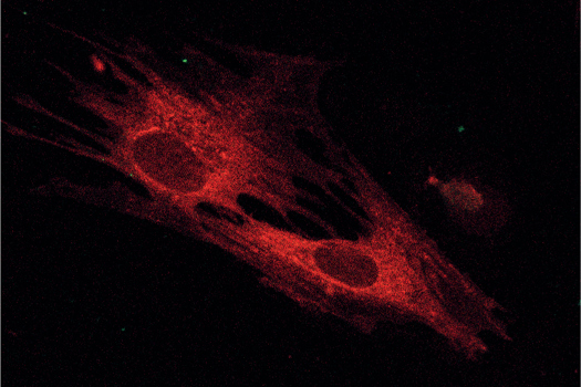 Figure 1. Equine mesenchymal stem cells in culture. These cells can be recovered from a variety of mesenchymal tissues, the most commonly used being bone marrow and fat, but blood, umbilical cord and teeth are other sources that have been developed for clinical use.