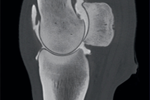 Figure 1. Arthrography of the standing equine fetlock joint