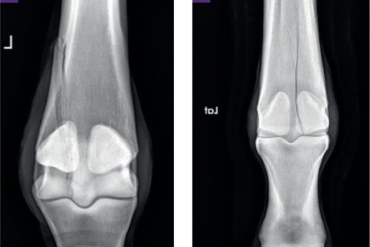 Figure 1. Flexed dorsopalmar/plantar radiographic views of the metacarpophalangeal joint showing (a) a typical, complete, minimally displaced lateral condylar fracture and (b) a typical incomplete medial condylar fracture with a spiralling configuration extending into the proximal diaphysis. Soft tissue swelling of the metacarpophalangeal joint is evident in both cases. The lateral aspect is to the left of both images.
