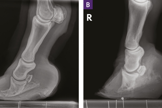Figure 8. 
a) A lateral radiograph of a foot with chronic laminitis demonstrating remodeling (a ‘ski tip’ appearance, arrow) of the dorsodistal tip of the third phalanx, consistent with chronic laminitis. Note this horse also has a very long toe (asterisk) in need of a trim. b) A lateral radiograph of a foot with chronic laminitis demonstrating osteopenia (circled) of the dorsodistal tip of the third phalanx, consistent with chronic laminitis.
