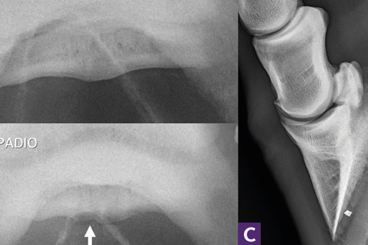 Figure 10. a) In the standard 55° navicular skyline image, sclerosis of the spongiosa is identified. The flexor cortex has decreased bone density, but a distinct defect is not visible. b) In a shallow angle (approximately 40°) navicular skyline image of the same horse, a focal irregular lucent defect is highlighted in the flexor cortex (white arrow). c) A mildly oblique upright lateromedial image catches the focal flexor cortex erosion in the distal aspect of the flexor cortex (white arrow).